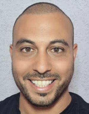 גל